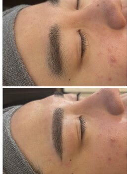 エステサロン ジュブリー/before after