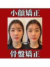 ビーバランス 本町店(美-Balance)&nbsp;小顔 矯正