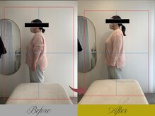 リン 大宮院(RIN)/骨膜整体での変化（担当：内田）