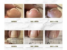 アインソフ(AinSoph)の雰囲気(巻き爪矯正メニューあり!フット角質ケア、スパ、パックもあり♪)