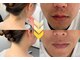 グランヴィール(GRANVIR)の写真/【美肌特化の顔脱毛】痛みに配慮した産毛ケアで化粧ノリ劇的UP♪肌悩みをケアしながら透明感あふれる素肌☆