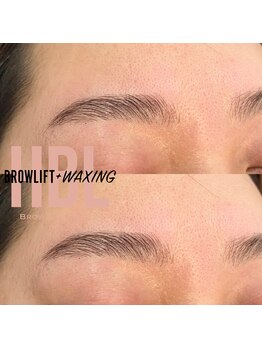 リトルリバー(Little River)/ハリウッドブロウリフト