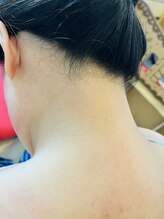 エヌ サロン(enu salon)/うなじwax