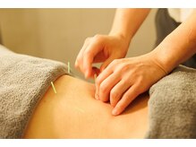 つぼぜん/【腰痛に鍼+整体】