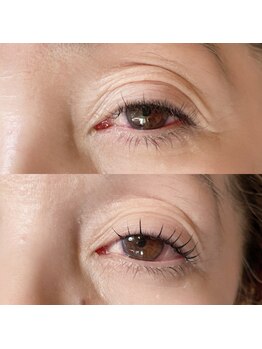 デイジー(DAY'S EYE)/エクステ+パーマ