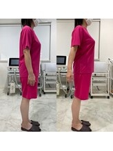 ギャラクシービューティー(galaxy beauty)/肩甲骨