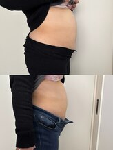 レアレア(Lea l'ea)/