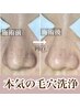 【2か月以内の再来店】毛穴プロコース90分 ¥11000