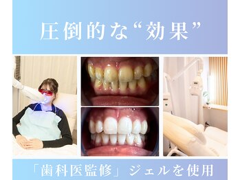 NAホワイトニング 自由が丘店