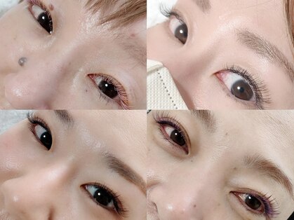 マツ(MATSU)の写真