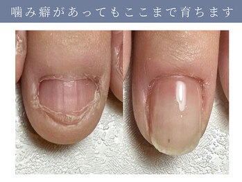 イデアル(ide’al)/あなたの爪もここまで変われる！