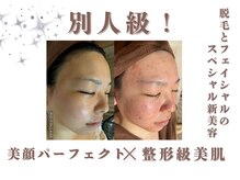 エステティック レイビス 銀座店(RAYVIS)/