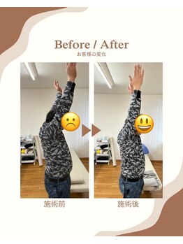リハ整体 新潟/施術前後