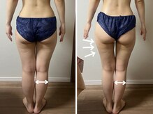 エルア 尼崎(Elua)の雰囲気（むくみ・脂肪にアプローチ、1回でスッキリ実感！）