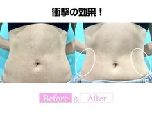 小顔専門カンナムビューティー 麻布十番店【ララピール/ハーブピーリング/小顔/痩身】/オンダリフト/麻布十番／六本木