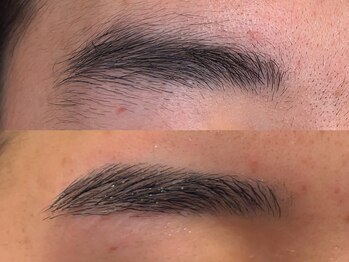 アンベリール(Embellir)/眉毛beforeafter