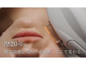 ラシェ プリズ 心斎橋の写真/【大人のニキビ（跡）・凸凹】厚塗りで隠すのを卒業。お肌を土台から入れ替えるケア[心斎橋駅7分]