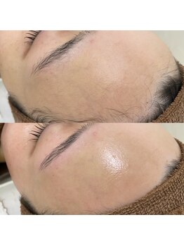 ルミナ 浦添店(Lumina)の写真/【毛穴×産毛ケア】低刺激ワックスで徹底オフ◎似合わせ眉との相乗効果で、一気に垢抜けるなめらか艶肌へ