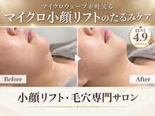 シルキーエービューティー(Silky A Beauty)