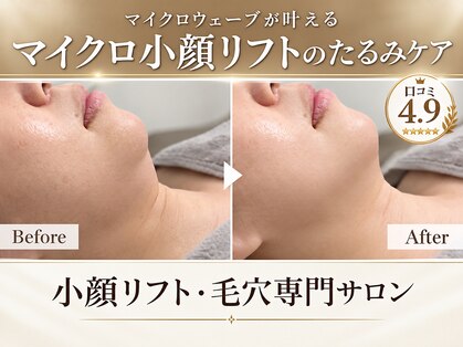 シルキーエービューティー(Silky A Beauty)の写真