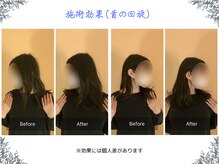 ボディ リセット アンド デザイン(Body Reset & Design)/【施術例】ビフォーアフター