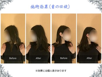 ボディ リセット アンド デザイン(Body Reset & Design)/【施術例】ビフォーアフター