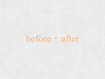 ホワイトニングショップ 名古屋店/【ビフォーアフター】