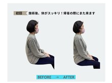 すこやか鍼灸整体院/姿勢矯正直前直後