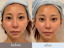ビューティースタジオ韓美 銀座店/お客様のbefore/after