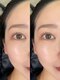 ボニー(BONNY)の写真/LEDエクステ×技術力で究極のモチを実現！！汗、水に強いこだわりのグルーを使用！施術後すぐ水濡れOK◎