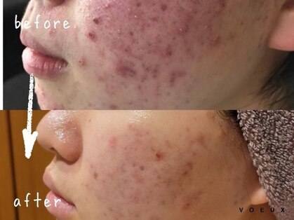 ボウ 名古屋店(VOEUX)の写真