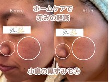 ポノ(Pono)/ホームケアで毛穴ケア☆ツヤ肌へ