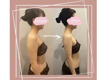 ソワ(sowa)/デコルテビフォーアフター