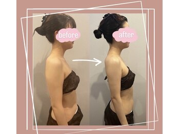 ソワ(sowa)/デコルテビフォーアフター