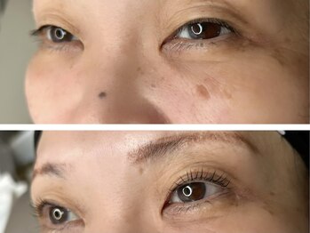 ラニ(Lani)/ラッシュリフト