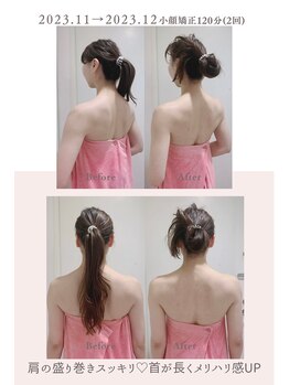 トゥインクル 麻布(twinkle)/麻布十番/シンメトリー小顔矯正