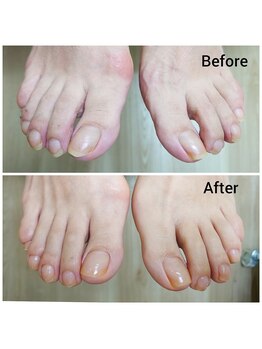 リゼラアンドコー 神戸店/