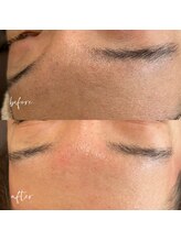 ノン(Non.)/ヌクレールフェイシャルワックス