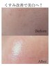 【陶肌+美白のダブル効果】高濃度美白成分を肌へ　ハーブピーリング　13000円