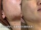 ソワンエステ アンジュの写真