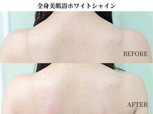 サンビ(SANBI)/全身のお肌くすみのケアに最適！