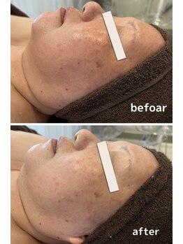 グラサヴォーグ 金沢店/肌の白さにびっくり！