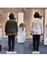 カワル整体 上通り院/お尻が痛い人