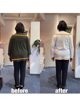 カワル整体 上通り院/お尻が痛い人