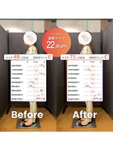 うぃず鍼灸整骨院/【数値で歪みを可視化します】