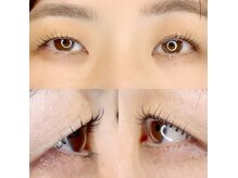 グロウビューティー(grow beauty)/