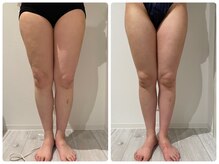 ルナグランデ(Luna grande.)/効果写真