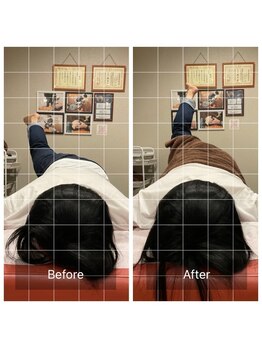 ナオル整体 宮崎院(NAORU整体)/20代女性施術事例【股関節伸展】