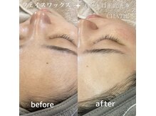 チャティー(CHATIE)の雰囲気（【艶肌♪フェイスワックス＋ハイドロ毛穴洗浄】肌質改善！！美白）