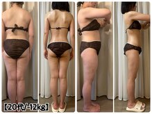 フォルスボーテ(Force Beaute)の雰囲気（骨格痩身トリートメント★15.800円 本町/痩身/脂肪分解/阿波座）